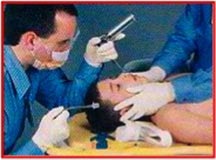 intubate