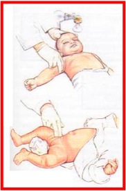 brachial femoral diagram